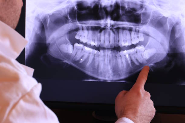 Best Emergency Tooth Extraction in Hamburg, PA