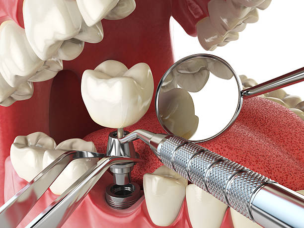 Best Emergency Dental Care for Broken or Chipped Teeth in Hamburg, PA